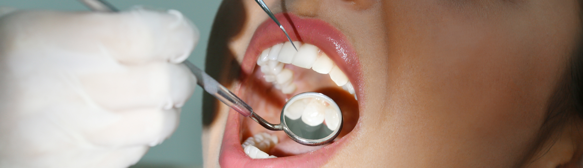 Como Tratar Pacientes Com Dentes Pequenos?